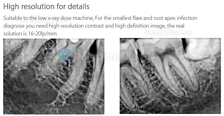 Handy HDR-600 Digital Dental X-Ray Imaging System X ary Sensor Machine